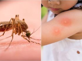 Trẻ bị muỗi đốt viêm đỏ, bôi gì cho nhanh khỏi và an toàn?